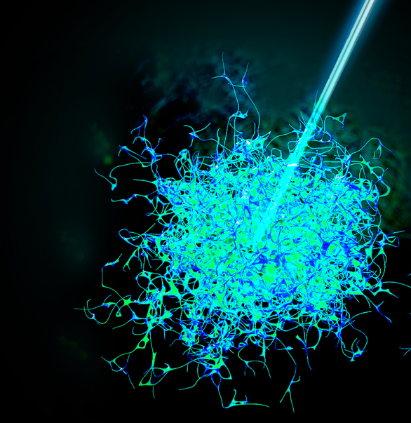 今天，我們把腫瘤的內部「融穿」了