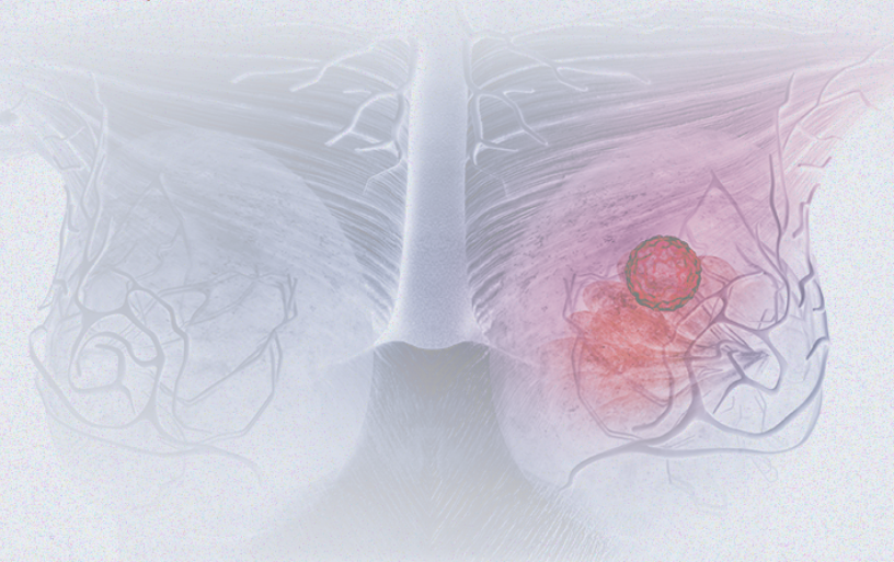 國際婦女節 | 關(guān)注乳腺癌 微創(chuàng  )介入讓美麗繼續，「乳」愿以?xún)斦蔀楝F實(shí)
