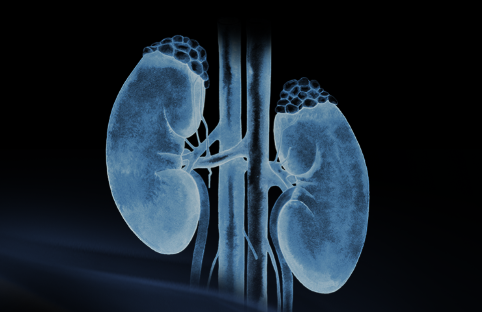 世界腎臟日 | 相得「腎」歡，融有術(shù)、精準適形