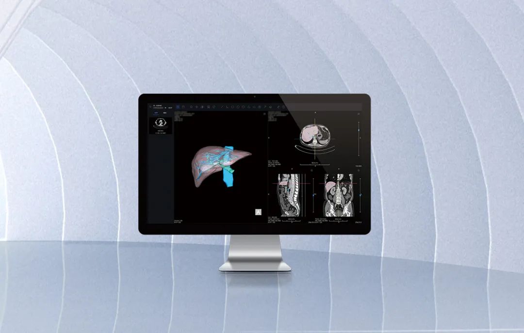 北京市首款！海杰亞醫療自主研發(fā)的AI+肝臟CT影像處理軟件獲批上市！
